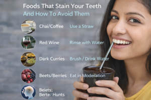 Find teeth stains caused by food and drinks at Kotadias Dental Care