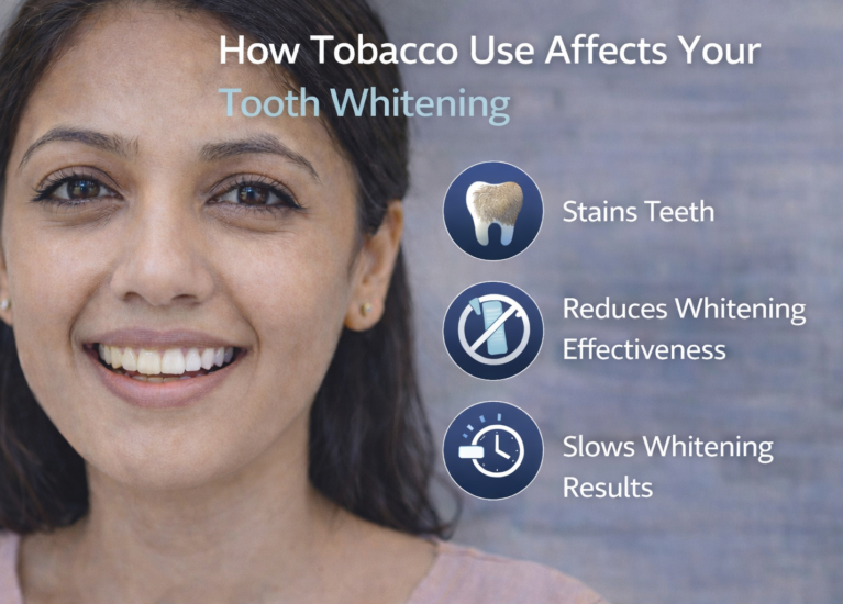 search dental whitening results for tobacco users at Kotadias Dental Care