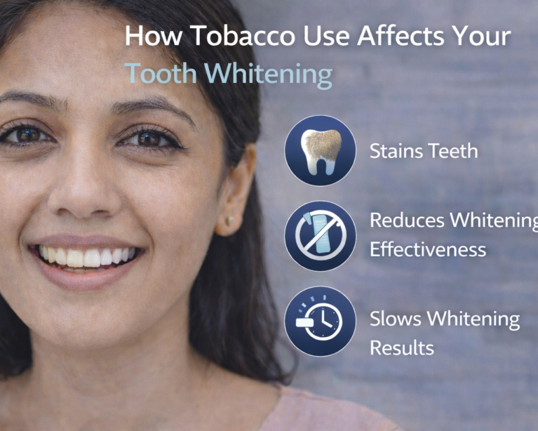 search dental whitening results for tobacco users at Kotadias Dental Care