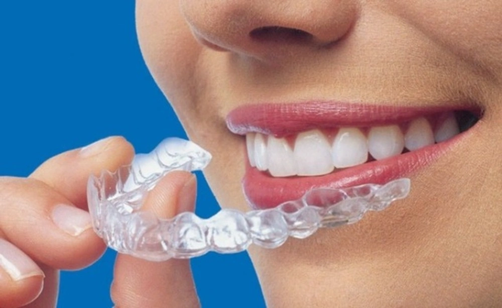 Find Best Invisalign Aligner in Bibwewadi.